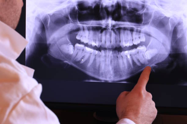 Best Emergency Treatment for Dental Infections or Abscesses in West Livingston, TX