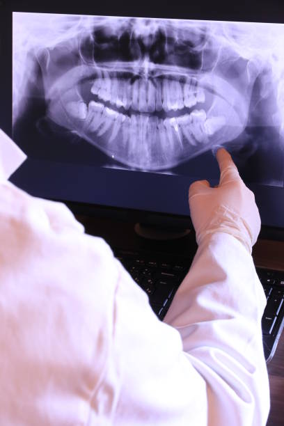 Best Same-Day Emergency Dental Services in West Livingston, TX
