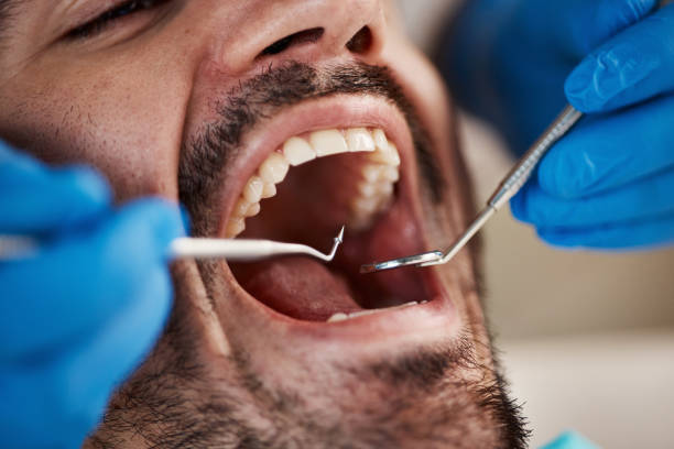 Best Pediatric Emergency Dentist in West Livingston, TX